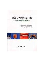 보철 수복의 최신 기법 -Galvanoforming-