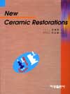 New Ceramic Restorations