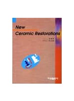 New Ceramic Restorations