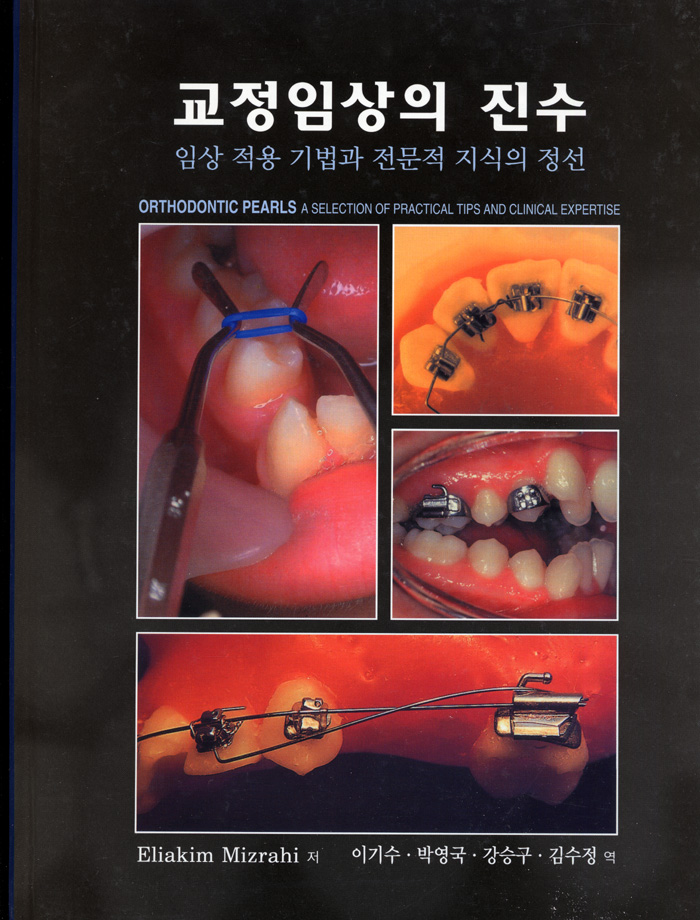 교정임상의 진수 - 임상 적용 기법과 전문적 지식의 정선 -