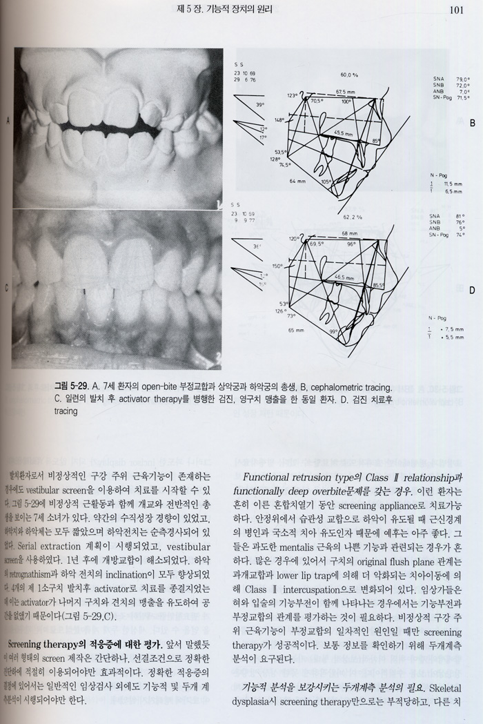 기능성 장치를 이용한 악안면 정형술 (Dentofacial Orthopedics with Functional Appliances) 