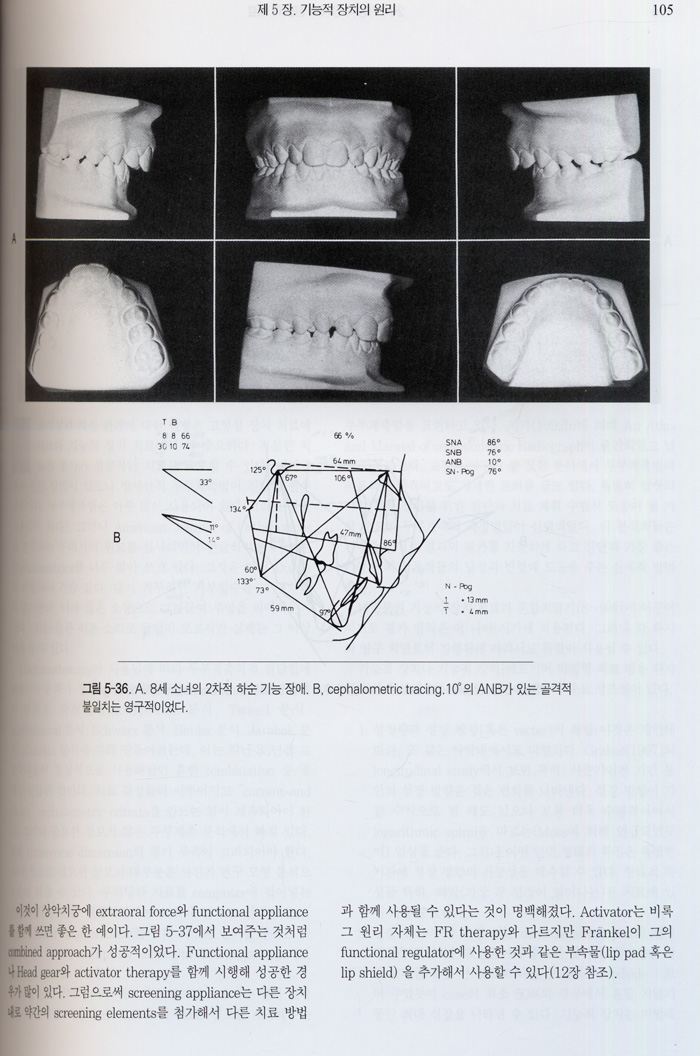 기능성 장치를 이용한 악안면 정형술 (Dentofacial Orthopedics with Functional Appliances) 