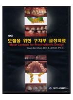 (DVD)보철을 위한 구치부 교정치료(Molar Controls for Prosthodontic Design)