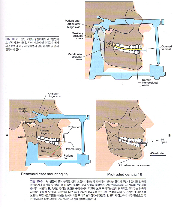 Misch 치과 임플란트 보철학 - Dental Implant Prosthetics -