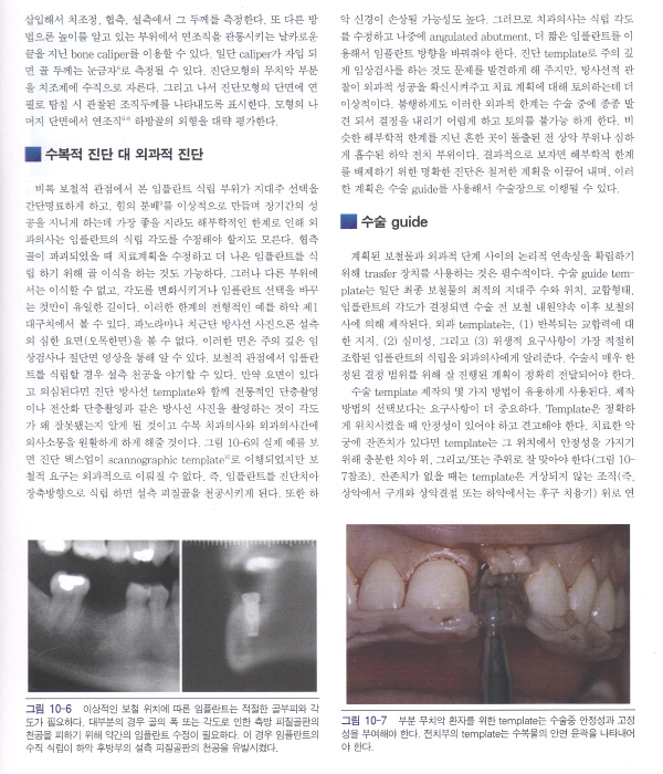 Misch 치과 임플란트 보철학 - Dental Implant Prosthetics -