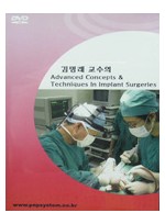 김명래 교수의 Advanced Concept ＆ Techniques in Implant Surgeries - DVD
