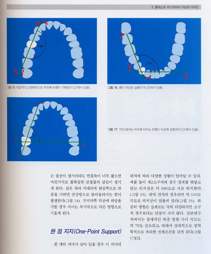 Contemporary Partial Denture System: 최신국소의치임상 및 기공