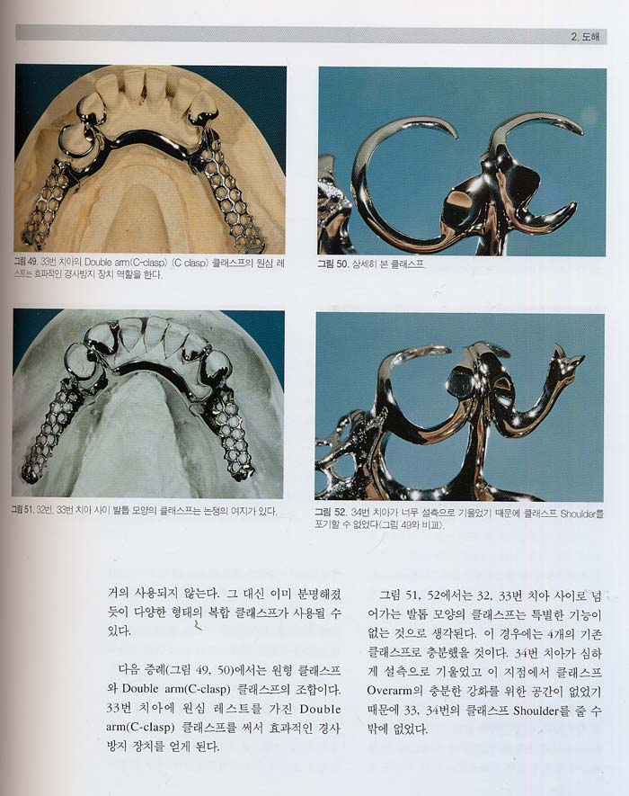 Contemporary Partial Denture System: 최신국소의치임상 및 기공