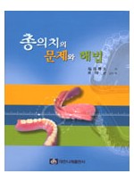 총의치의 문제와 해법