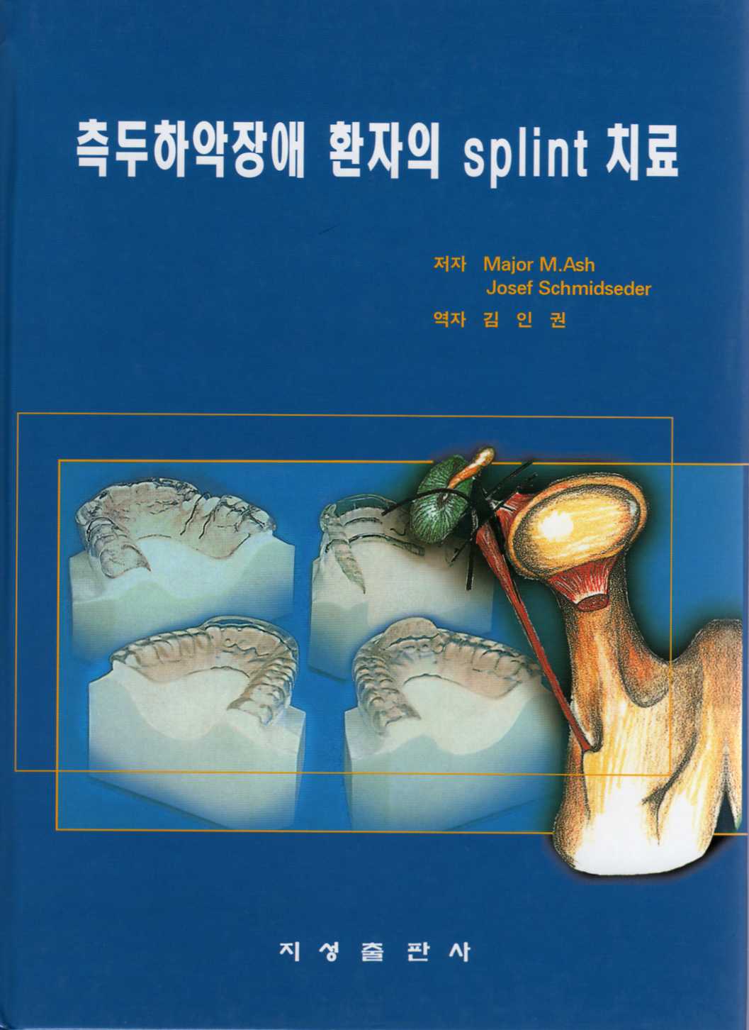 측두하악장애 환자의 splint 치료