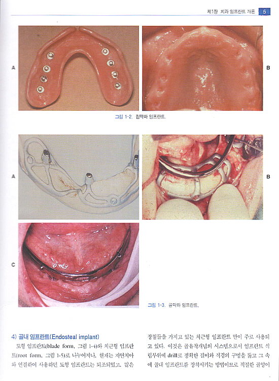 구강악안면 임프란트학 Vol. l