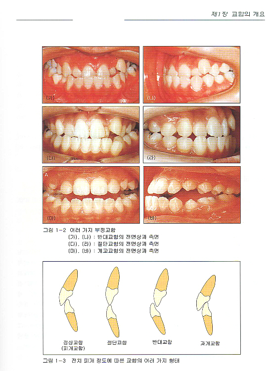 교합과 교합면 형성[치기공과 교재]