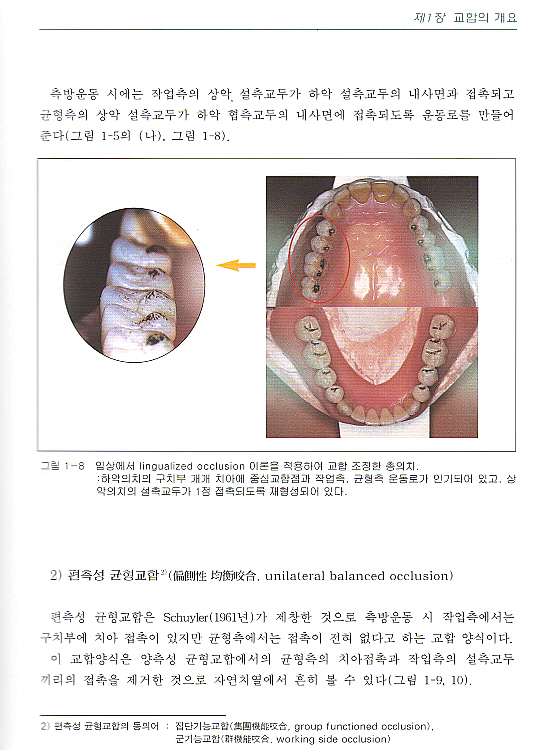 교합과 교합면 형성[치기공과 교재]