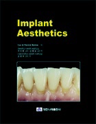Implant Aesthetics