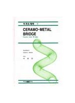 치과도재학 II CERAMO-METAL BRIDGE