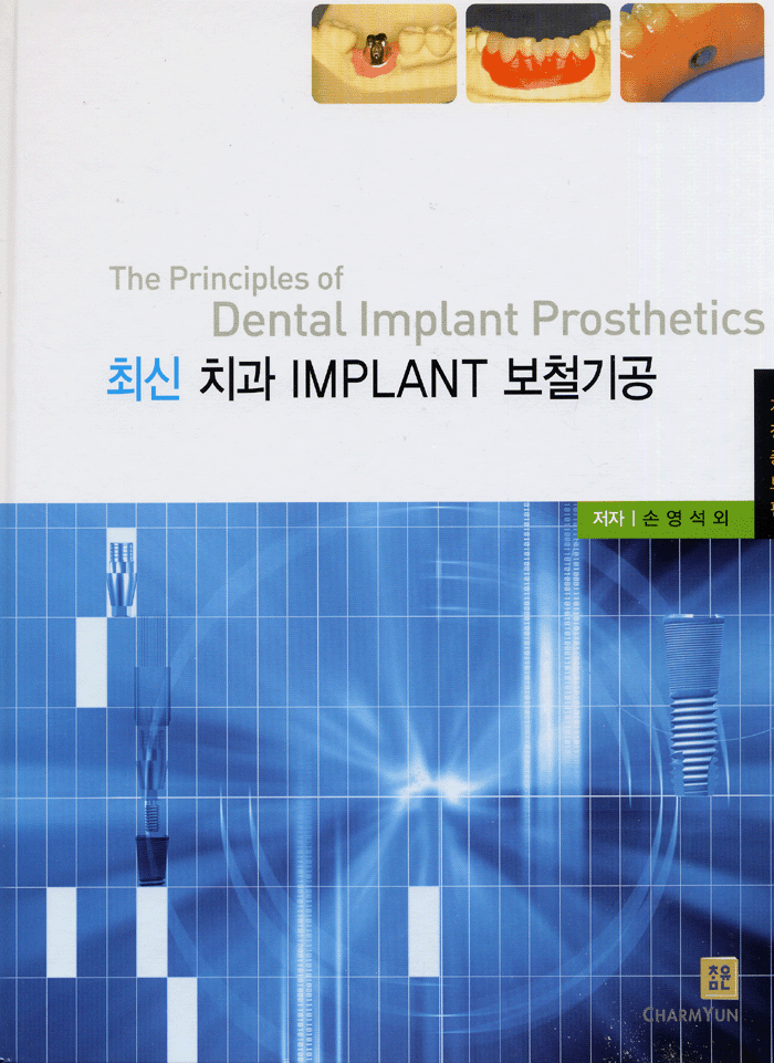 최신 치과 IMPLANT 보철기공 2판