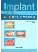 증례로 보는 다양한 임프란트 보철수복학