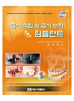 즉시 식립 및 즉시 부하 임플란트(부록 동영상 CD포함)