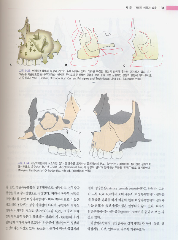 발치 후 즉시 식립 임플란트 & 치조정 접근법에 의한 상악동 거상술