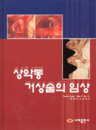 상악동 거상술의 임상