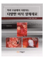 치과수술에서 사용되는 다양한 이식 생체재료