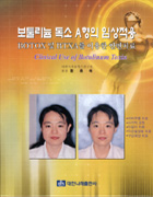 보툴리늄 독소 A형의 임상적용 BOTOX 및 BTXA를 이용한 안면치료