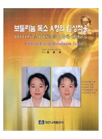 보툴리늄 독소 A형의 임상적용 BOTOX 및 BTXA를 이용한 안면치료