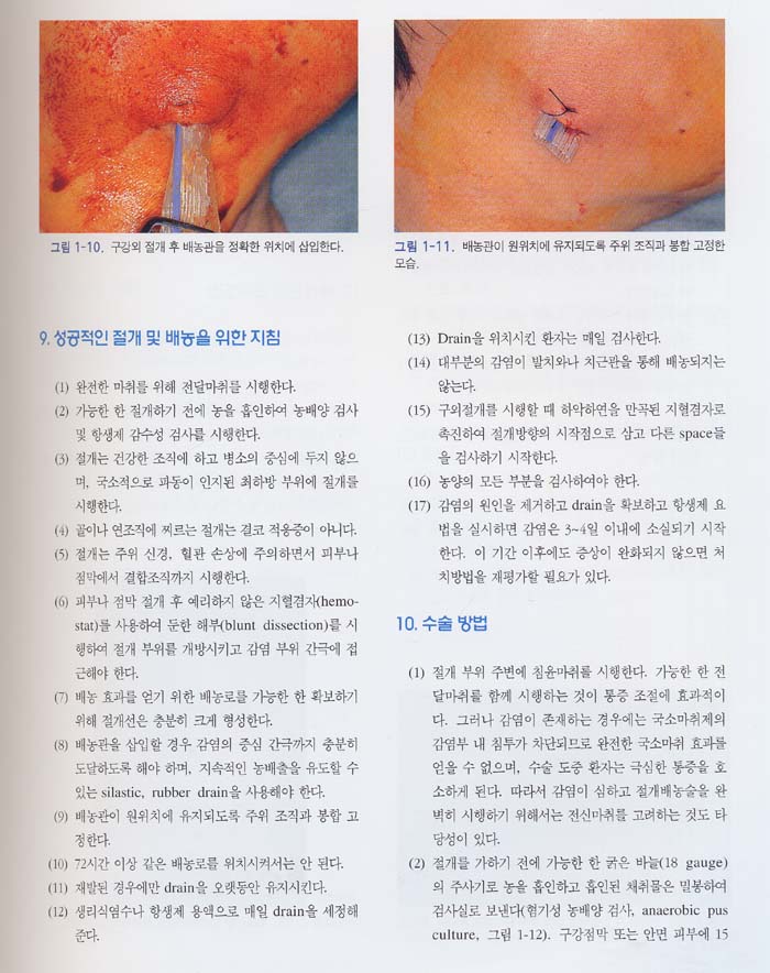 임상치과소수술 Clinical Minor Oral Surgery(Surgery CD)