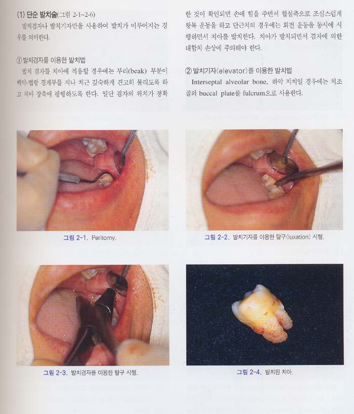 임상치과소수술 Clinical Minor Oral Surgery(Surgery CD)