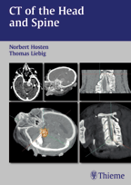 CT of the Head and Spine