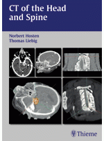 CT of the Head and Spine