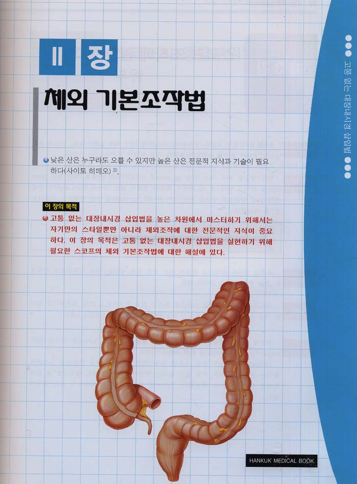 고통 없는 대장내시경 삽입법