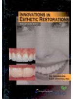 임상 심미수복 테크닉 (Innovations in Esthetic Restorations)