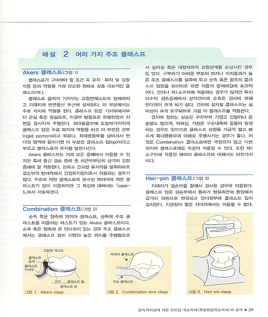 국소의치 아틀라스 - 설계이론과 임상 유리단 국소의치를 중심으로