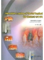 Immediate Loading Of Dental Implant 치과 임프란트의 즉시부하