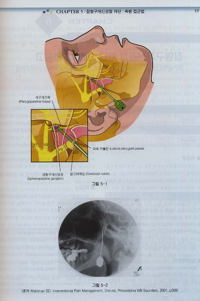 왈드만 통증시리즈-아틀라스 중재적 통증치료