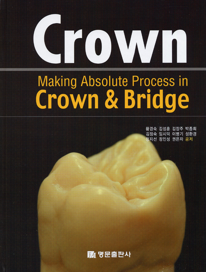 Crown - Making Absolute Process in Crown & Bridge