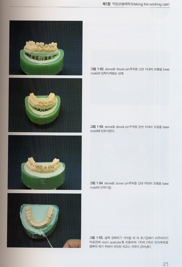 Crown - Making Absolute Process in Crown & Bridge