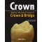 Crown - Making Absolute Process in Crown & Bridge