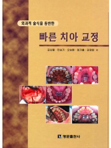 외과적 술식을 동반한 빠른 치아 교정
