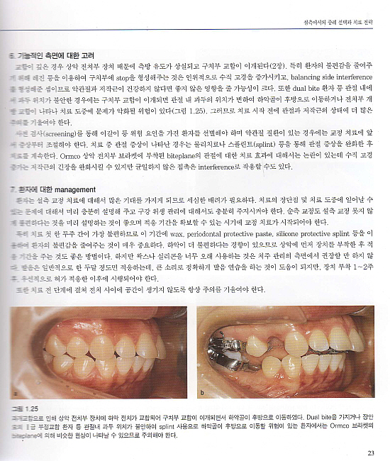 도해로 보는 최신 성인교정치료 Vol.II - 설측교정치료