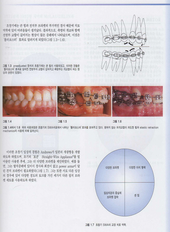 체계적인 임상교정치료 -Systemized Orthodontic Treatment Mechanics-