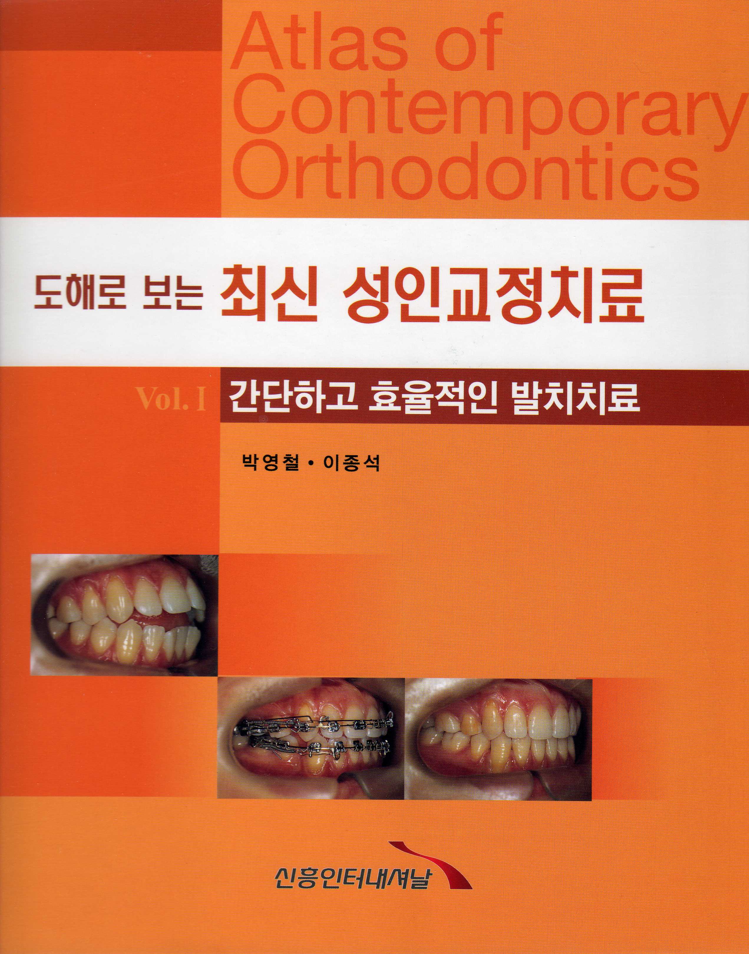 도해로 보는 최신 성인교정치료 Vol. I - 간단하고 효율적인 발치치료 -