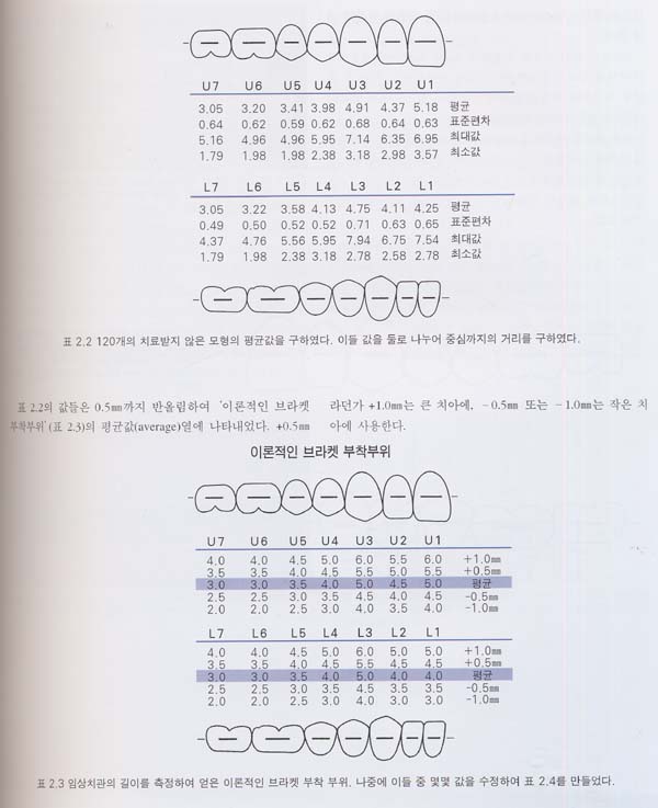 Preadjusted Appliance를 이용한 교정치료