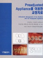 Preadjusted Appliance를 이용한 교정치료