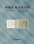 지대치 형성의 기본(Fundamentals of Tooth Preparations)