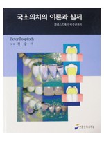 국소의치의 이론과 실제 - 클래스프에서 이중관까지 -