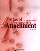Atlas of Precision Attachment (최신 심미보철을 위한)