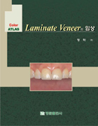 Color Atlas Laminate Veneer 의 임상