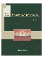 Color Atlas Laminate Veneer 의 임상